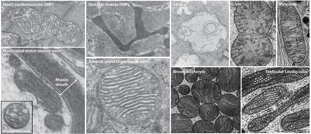 Not All Mitochondria Are the Same